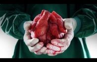 Ausgeschlachtet – Organe auf Bestellung (DOKU 2016 HD)