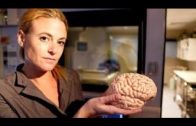 BBC Documentary 2017 – Food on the Brain – BBC Documentary BBC horizon 2017