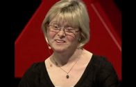 I have one more chromosome than you. So what? | Karen Gaffney | TEDxPortland