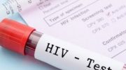 Ich habe AIDS!! Wie HIV das Leben verändert Doku 2016 NEU in HD