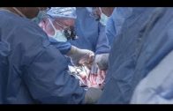 Moderne Transplantation – Ein neues Herz für den Mensch (Doku 2017 NEU HD)